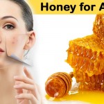 Incredible-Honey-Skin-Care-Tips-to-Reduce-Acne-Problems