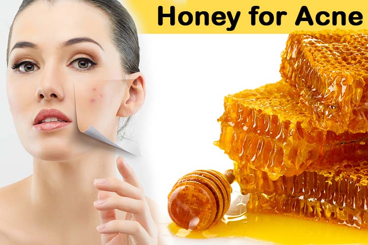 Incredible-Honey-Skin-Care-Tips-to-Reduce-Acne-Problems