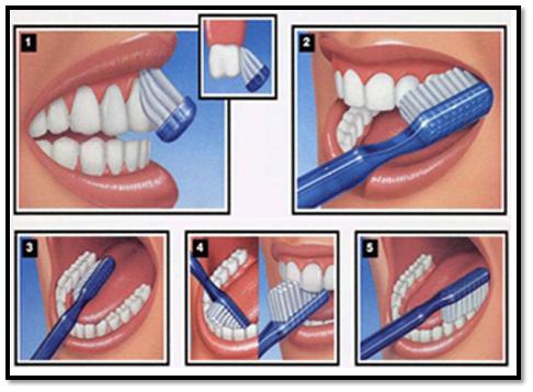 Proper-Tooth-Brushing