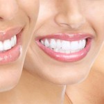 Cosmetic-Dentist-to-Fix-Your-Smile