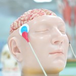 Transcranial Magnetic Stimulation2