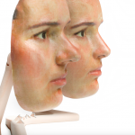3D_Mask_Rhinoplasty