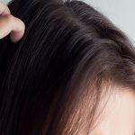 best shampoo for scalp sores