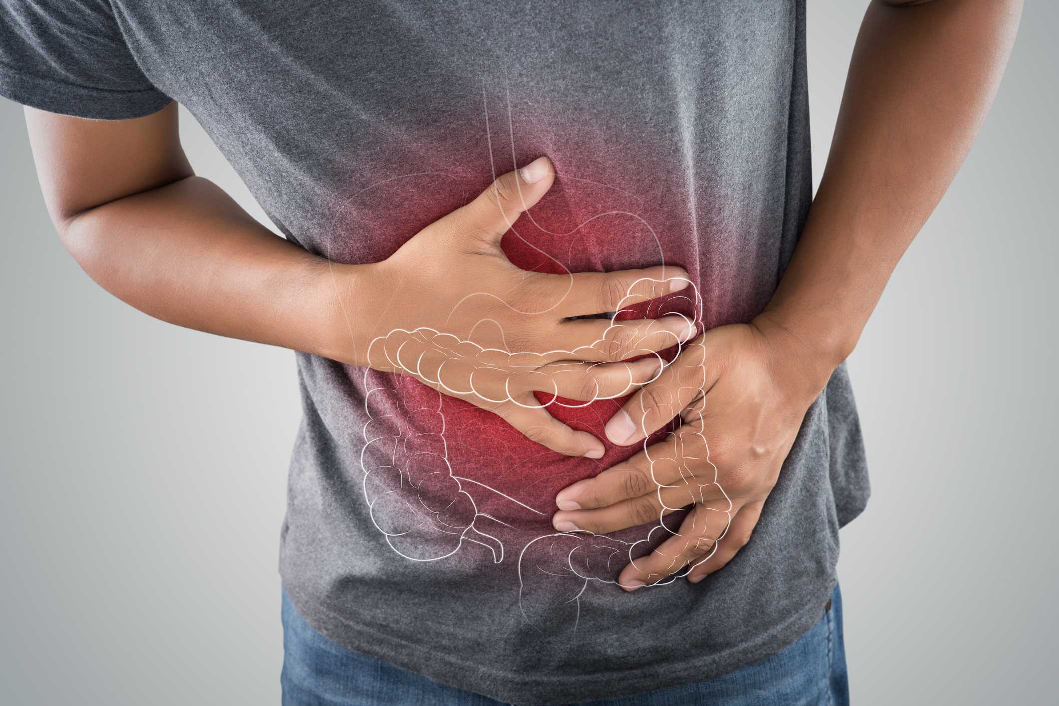 Where to Find Long Island NY Colorectal Specialists for Colon and Rectal Surgery