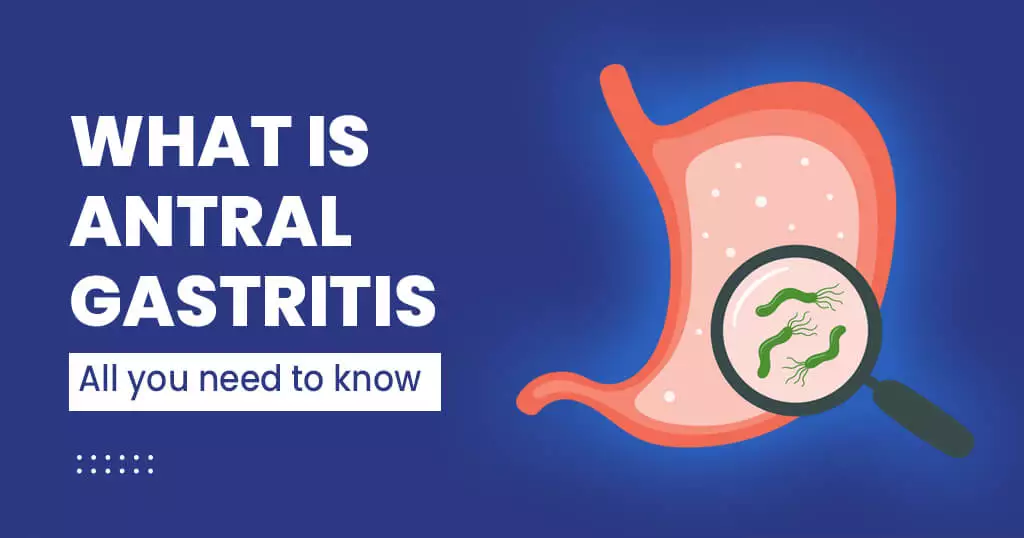 Gastritis Treatment